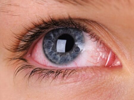 How to relieve eye strain